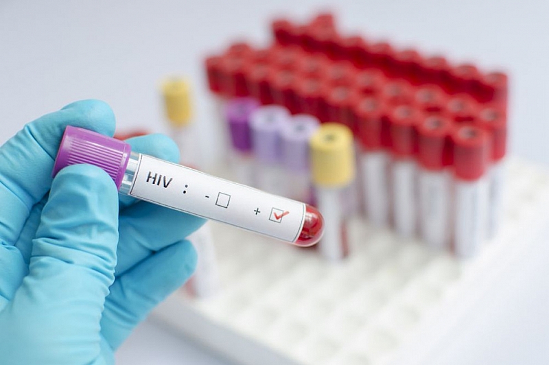 Проблемът с лекарствата за ХИВ в София е временно решен