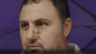 Вижте нахапания мъж от разярен питбул в Брацигово