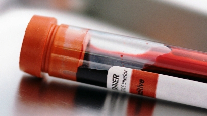 Пияният лекар от Дупница дал чужда проба кръв