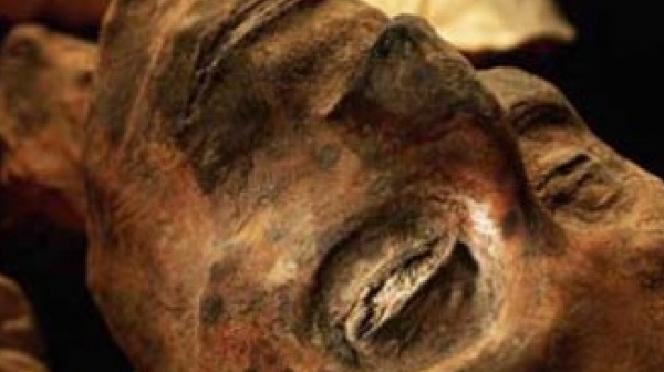 Учени откриха раково образувание в египетска мумия