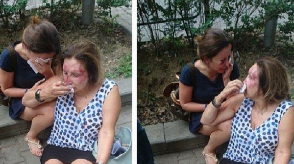 Все още издирват мъжете, които пребиха две жени в Борисовата градина