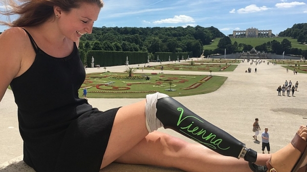 Млада американка преобрази изкуствения си крак и вдъхнови хиляди