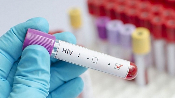 Няма лекарства за ХИВ в страната