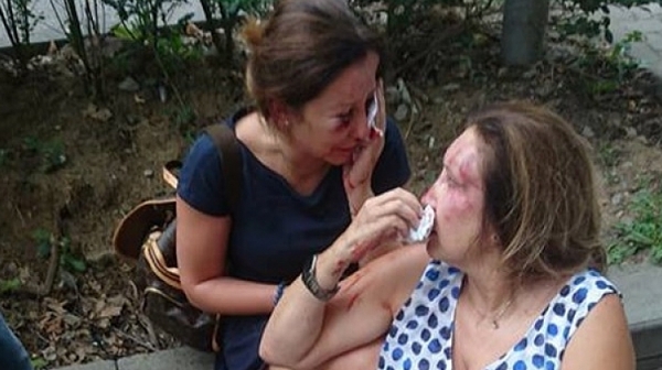 Хулигани с маски смляха от бой жени нотариуси в Борисовата градина