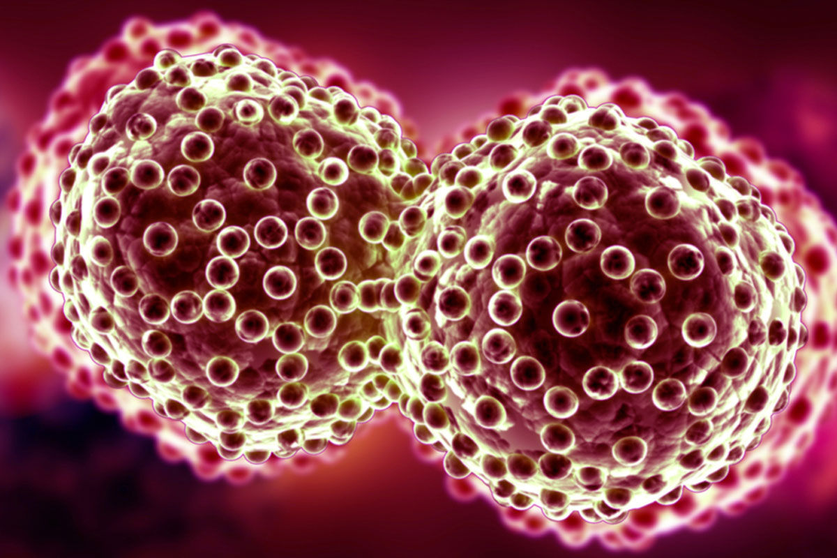 Терапията използва РНК молекули доставяни чрез наночастици директно в раковите