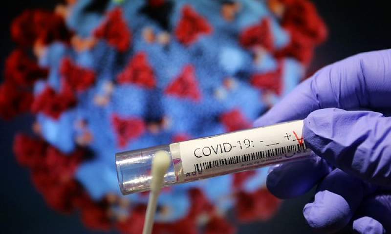 Общият брой на потвърдените случаи на коронавирус у нас достигна