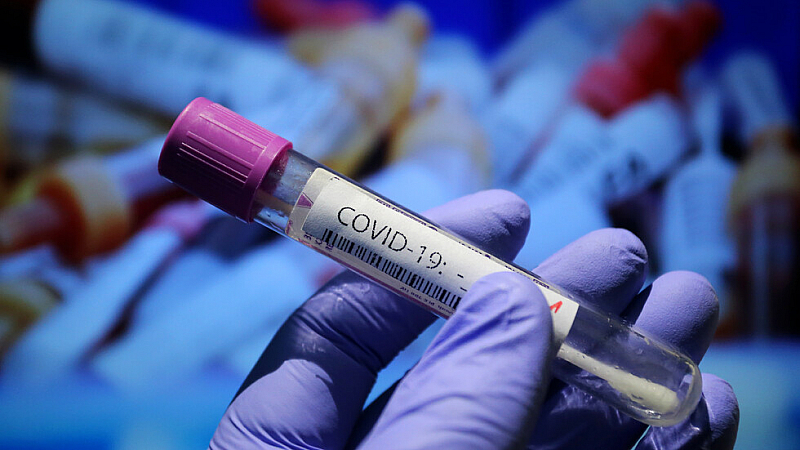 41 са новите случаи на коронавирус у нас. Това показват