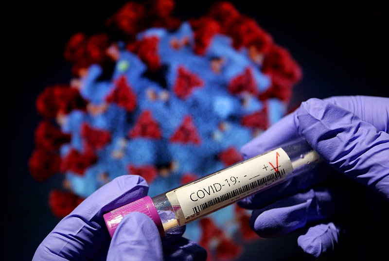 Общият брой на потвърдените случаи на заразяване с коронавируса у