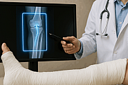 AI ще помага на лекари да откриват счупвания и изкълчвания