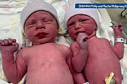Родиха се първите в света близнаци от ембриони, замразени преди 30 години