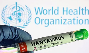 Потвърдиха случай на хантавирус в Румъния