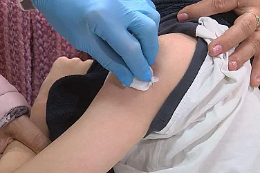 Морбили като предупреждение. Спадът във ваксинацията връща забравени рискове