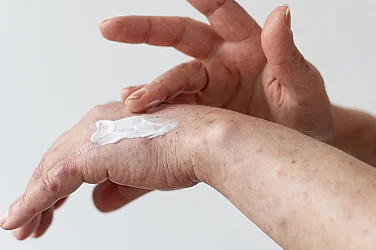 Дерматолози: Зимата е най-тежкият сезон за кожата