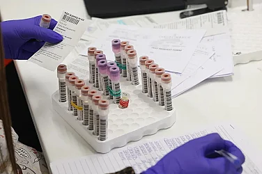 Промяна в Имунизационния календар: Ваксината срещу варицела става задължителна от юли