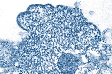 Какво е вирусът Нипа и защо експертите не го сравняват с COVID-19