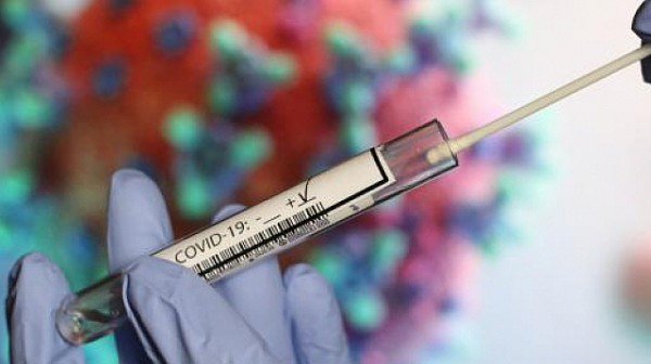 240 са новите случаи на коронавирус у нас