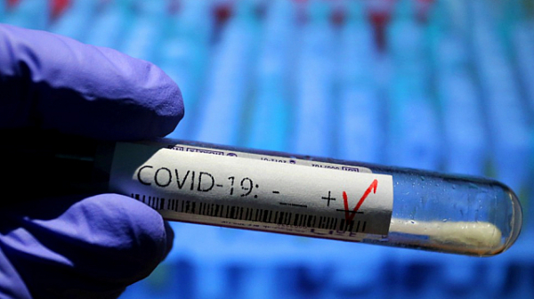 За последното денонощие са регистрирани 2836 инфекции COVID-19