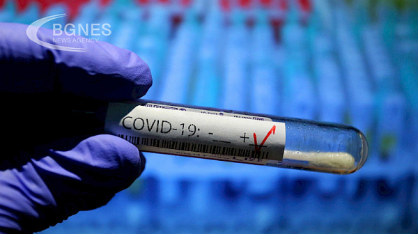 21 са новите случаи на коронавирус у нас, в болници за лечение остават 152 пациенти