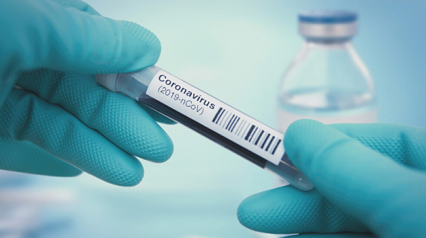 СЗО: Открихме бърз и евтин тест за коронавирус