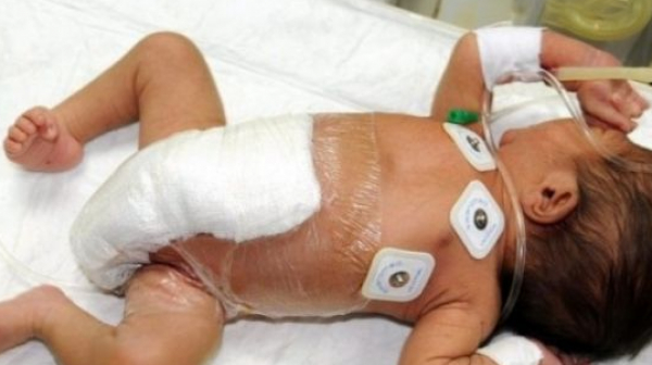 Изоставиха бебе пред медицински кабинет в Петрич