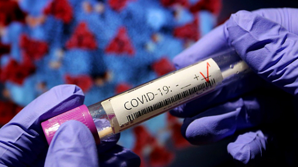 488 нови случая на коронавирус у нас