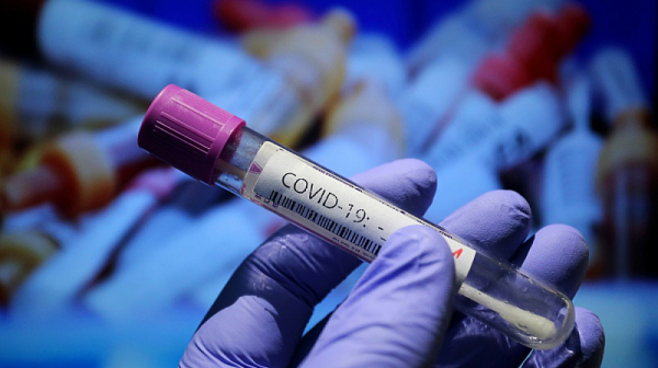 Броят на заразените с COVID продължава да расте. Новите случаи са 1862