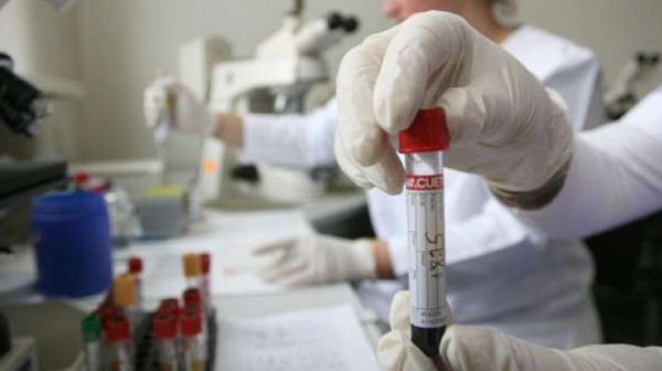 Учени съобщиха за четвърти човек, излекуван от ХИВ