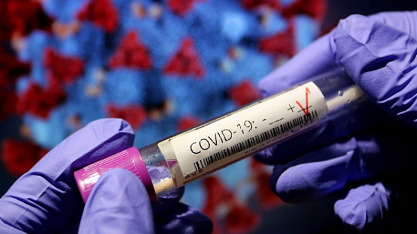 8932 нови случаи на коронавирус у нас