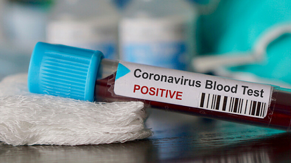 Д-р Николова: За карантината за коронавируса се дават болнични