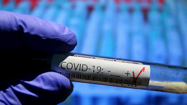 Още намаляват случаите на COVID-19 у нас