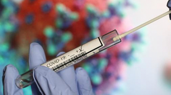 226 нови случаи на коронавирус у нас