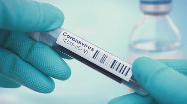 1143 нови случаи на коронавирус у нас