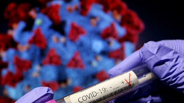 393 нови случаи на коронавирус, 36 души починали