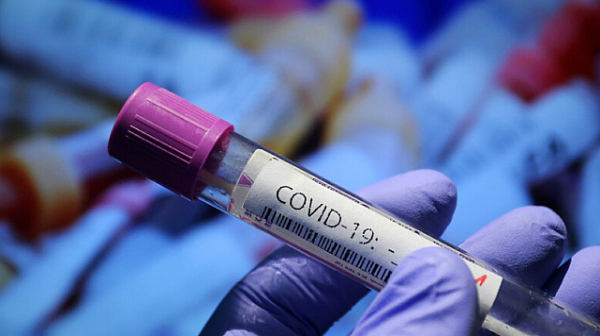 105 случаи на COVID-19 за денонощието, 4-ма починали