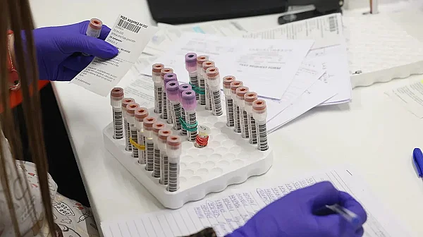 Промяна в Имунизационния календар: Ваксината срещу варицела става задължителна от юли