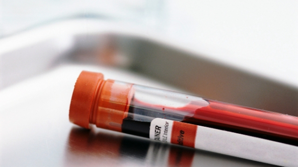 Турция ни дарява тестове за коронавирус