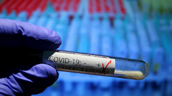 1076 нови случаи на COVID-19, положителни са близо 14% от пробите