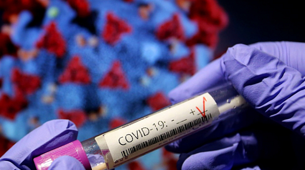 83 нови случая на заразени с коронавируса у нас