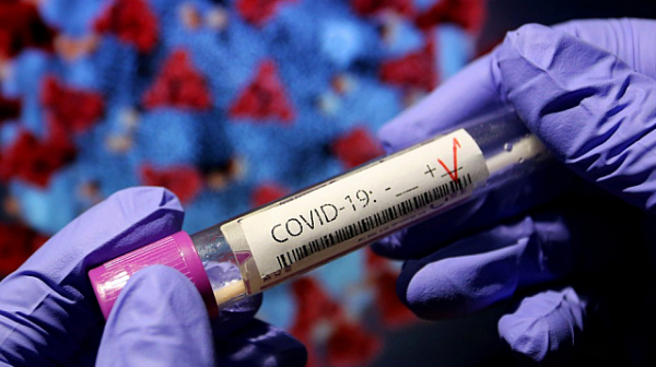 60 нови случая на коронавирус и двама починали през последното денонощие у нас