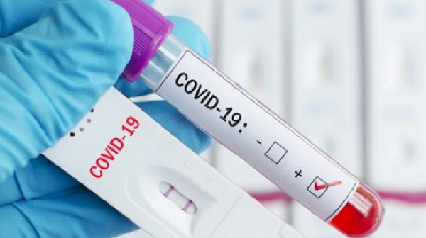 Нова заповед: Карантината за болните от COVID-19 изтича след 14-тия ден
