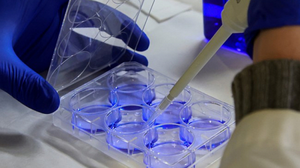 Няма да разкриват нови лаборатории за изследване на кръвни проби за алкохол и наркотици