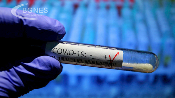 309 са новите случаи на коронавирус у нас, трима души са починали