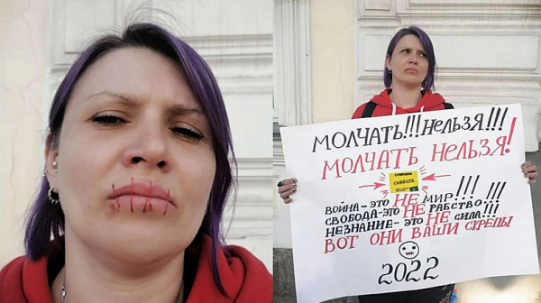 Надежда Сайфутдинова - рускинята, зашила устата си в знак на протест срещу войната