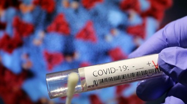 155 са новите случаи на коронавирус, 7 души са починали за денонощието