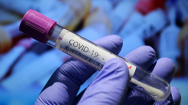17 са новорегистрираните случаи на коронавирус у нас, няма починали
