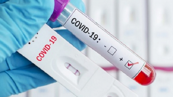 На фона на по-заразния щам на COVID-19: Франция иска негативен PCR за пътници от ЕС