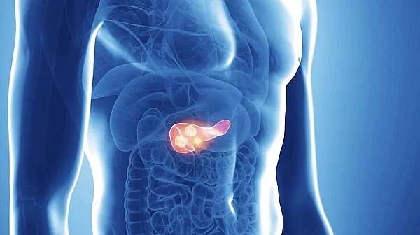 Пробив в онкологията: Испански учени постигнаха регресия на рак на панкреаса