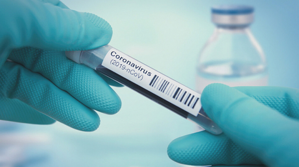 739 нови случая на заразени с COVID-19 при 1965 PCR теста