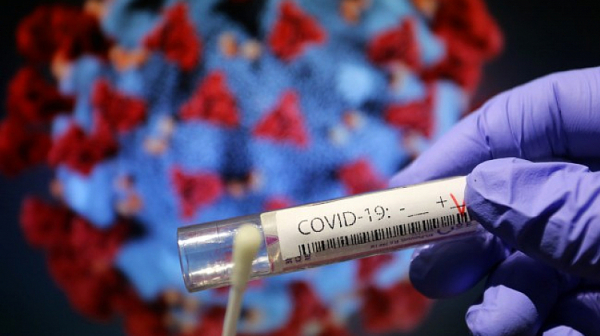 4 374 са новите случаи на коронавирус, 107 души са починали