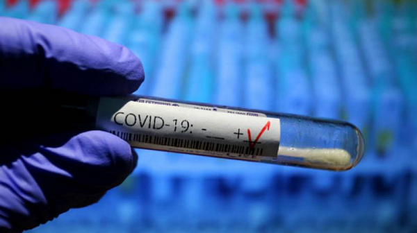 Близо 9% от тестваните за COVID-19 са положителни. Починалите са 164